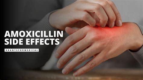 Amoxicillin Side Effects You Should Know About