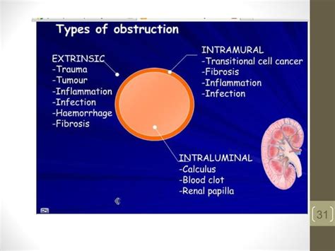 Urology 4 hydronephrosis | PPT