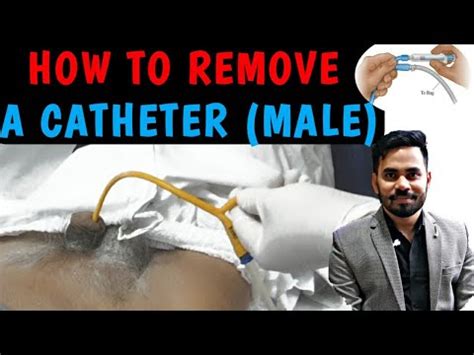 How to remove a catheter (male) | Remove foley catheter | Urinary catheter removal - YouTube