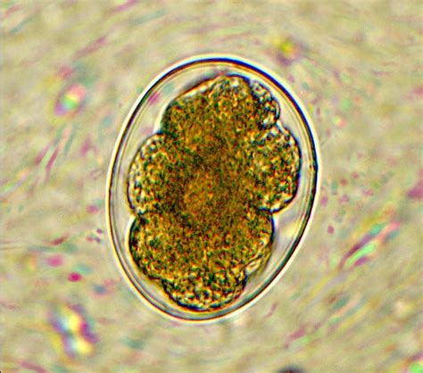 Ancylostoma duodenale – Egg – Parasitology