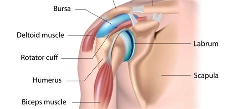 Shoulder Bursitis: Causes, Symptoms, Treatment