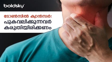 ചെവി വേദന, ഒച്ചയടപ്പ്, ഭക്ഷണം കഴിക്കാന്‍ ബുദ്ധിമുട്ട്: ടോണ്‍സില്‍ ക്യാന്‍സര്‍ തുടക്കം ഇങ്ങനെ ...