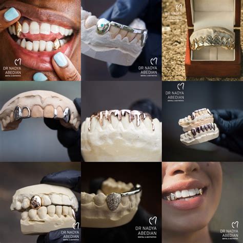 Custom grillz - Dr Nadya Abedian