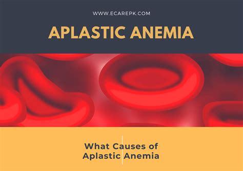 What is Aplastic Anemia? What Causes of Aplastic Anemia?