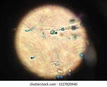 Fusarium Images, Stock Photos & Vectors | Shutterstock