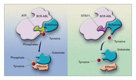 Targeting the BCR-ABL Tyrosine Kinase in Chronic Myeloid Leukemia | NEJM