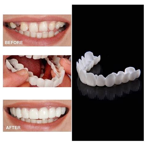 1Pair Snap On Bottom Upper & Lower Fake Teeth Dental Dentures Veneers ...