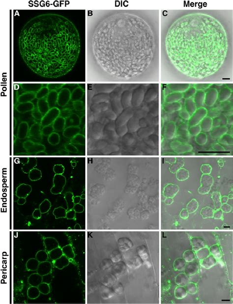 Amyloplast membrane localization of SSG6-GFP in various tissues.... | Download Scientific Diagram