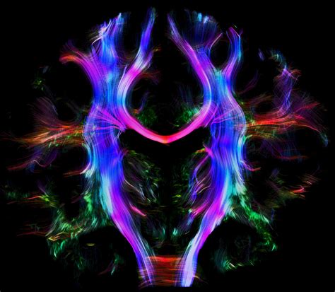 Indiegogo Campaign – Art at the Human Brain Mapping | The Neuro Bureau