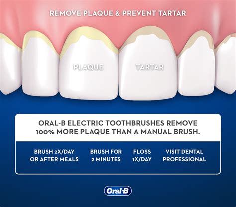 Dental Plaque Removal