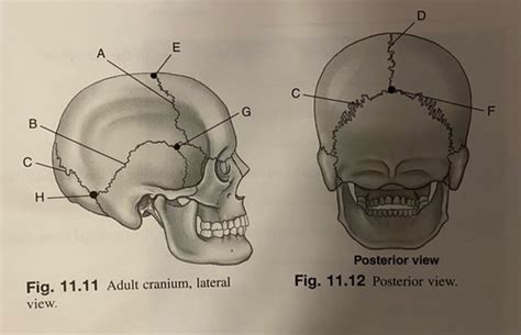 RAD 2120 Ch. 11 SUTURES / ASTERIONS Diagram | Quizlet