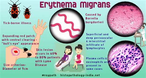 Pathology of Erythema Migrans - Dr Sampurna Roy MD