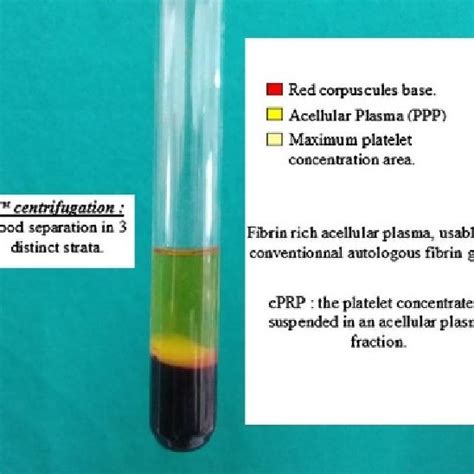 Blood centrifugation immediately after collection allows the... | Download Scientific Diagram