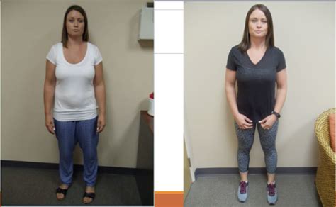 Medical Weight Loss – Before and After Photos