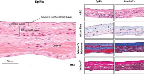 Histology of EpiFix V R and AmnioFix V R dHACM allografts. The left ...