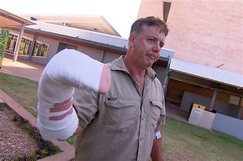 Australian 'a bit sore' after hand was caught in croc's jaws | The ...