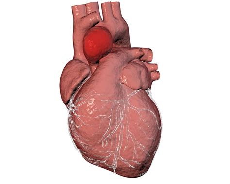 Bicuspid Aortic Valve Disease Be Dangerous? | Keyhole Heart Clinic