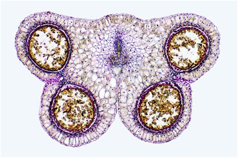 Lily anther, transverse section, showing pollen sacs | Nikon’s Small World