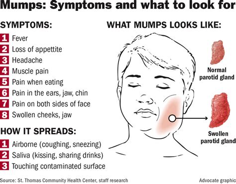 MUMPS VIRUS Diagram | Quizlet