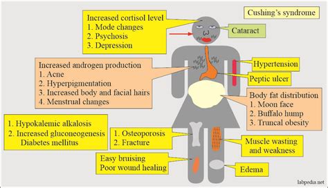 ACTH (Adrenocorticotropic Hormone), Cushing’s Syndrome – Labpedia.net