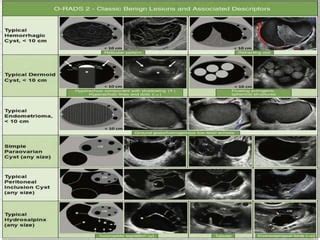 O'rads Radiology 2020 | PPT