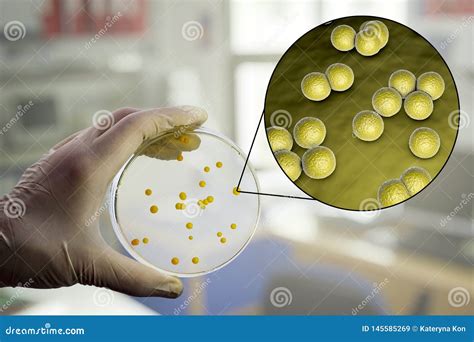 Colonies Of Micrococcus Luteus Bacteria On Agar Plate Royalty-Free Illustration | CartoonDealer ...