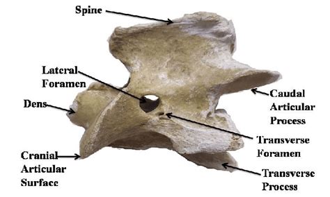 Lateral view of axis bone of Ox. | Download Scientific Diagram