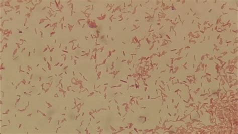 Moraganella morganii in Gram Staining - YouTube