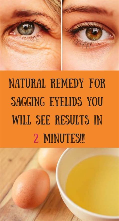 Natural Remedy For Sagging Eyelids You Will See Results In 2 Minutes ...