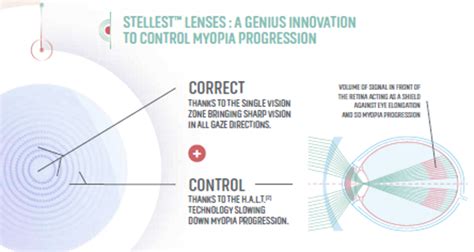 Essilor Launches Stellest Lenses in Singapore