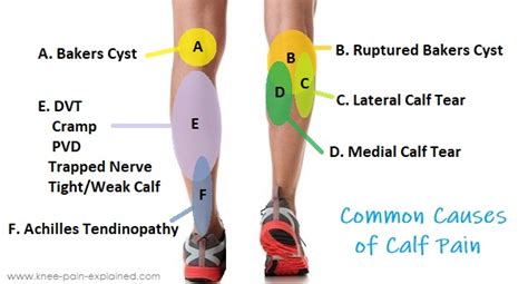 Foot Pain Diagnosis Diagram