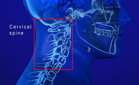 C3, C4, & C5 Vertebrae Spinal Cord Injury | SpinalCord.com