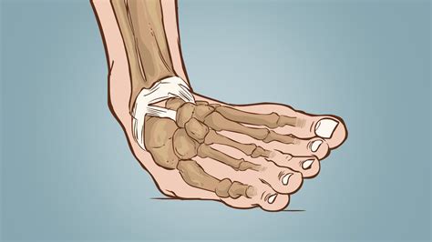 Anterior Drawer Test For Ankle Sprain - Jas fur Kid