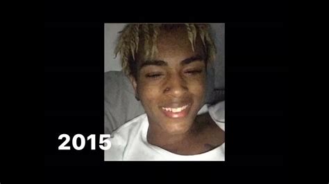 Evolution of XXXTENTACION Dreadlocks (R.I.P) - YouTube