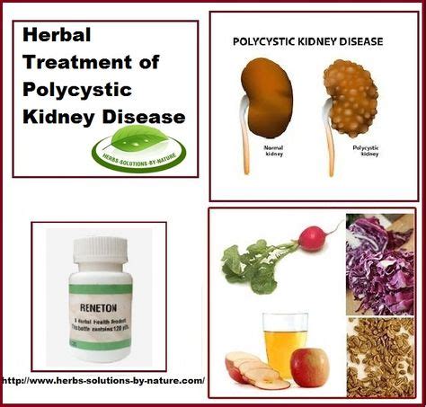 13 Polycystic Kidney Disease Treatment ideas in 2021 | polycystic kidney disease, polycystic ...