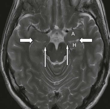 Overview of Anatomy, Pathology and Techniques; Aspects Related to Trauma | Radiology Key