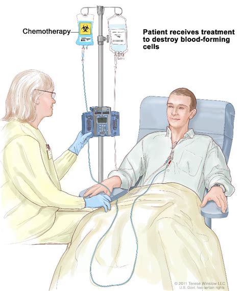 Leukemia Radiation Treatment