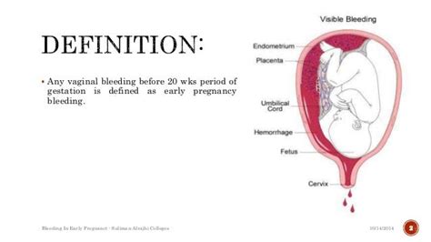 Bleeding From The Cervix During Early Pregnancy - PregnancyWalls