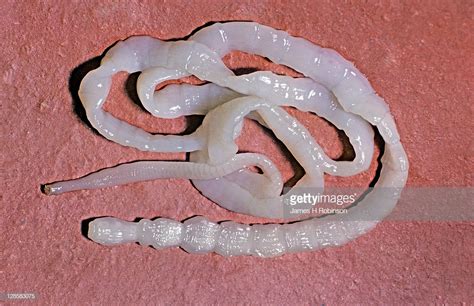 HEALTH EDUCATION BLOGIN: Parasitic Worms in Humans