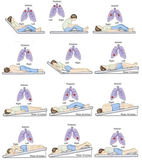 Chest PT | Physical therapy student, Pulmonology, Basic anatomy and ...