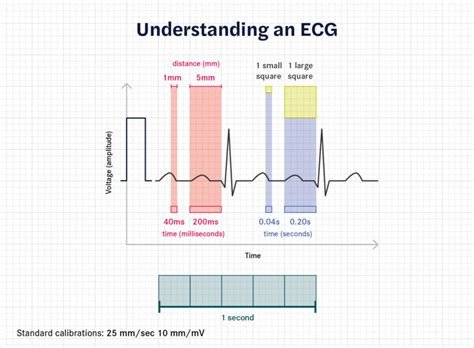 How to calculate heart rate from ECG (or EKG) - Seer Medical