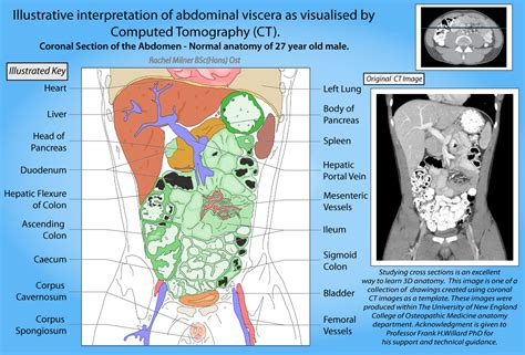 CT Abdominal Viscera - Illustrative interpretation of abdominal viscera as visualised by ...