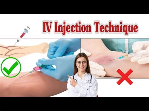 How to do an Intravenous (IV) Injection Procedure | IV Injection ...