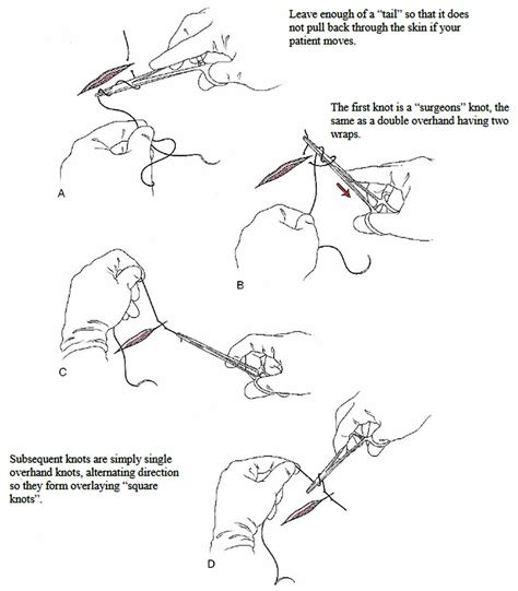 Surgical suture, types of sutures, sizes, how to suture & suture ...