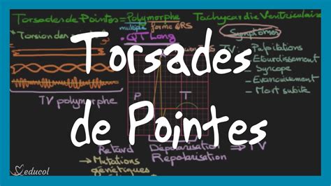 Torsades de pointes: ECG, symptômes, causes et traitement - YouTube