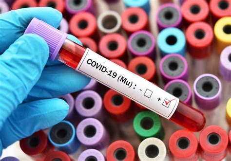 REGIONAL: Five cases of the Mu Variant of Covid-19 detected in SVG ...