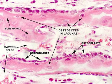 Endochondral Bone Formation Histology