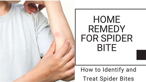 Home remedy for spider bite | How to Identify and Treat Spider Bites ...