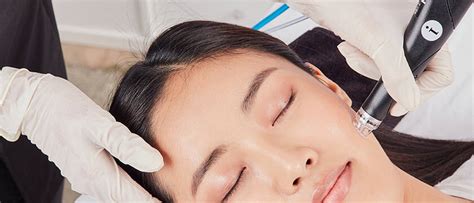 Hydrafacial vs Microdermabrasion-What Is Your Best Choice? - En Sante ...