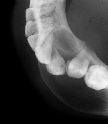 OCCLUSAL RADIOGRAPH 15 | buyxraysonline